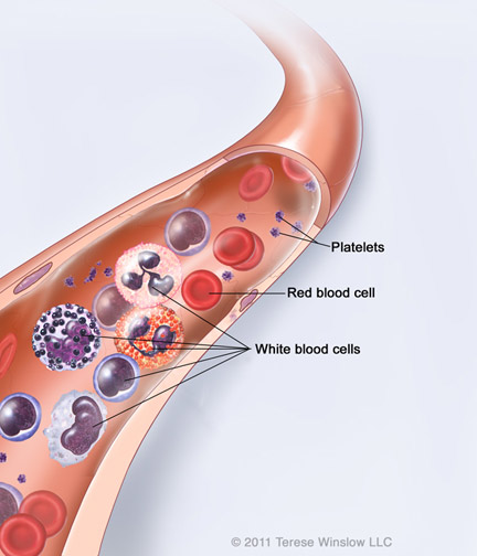 acute-lymphoblastic-leukemia-benjamin-the-brave